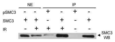 Immunoprecipitation: SMC3 [p Ser383] Antibody [NB100-208]